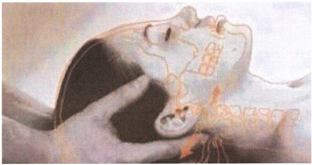 cranialsacral technique